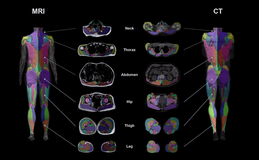 Rotating whole-body MRI and CT muscle segmentations with axial callouts